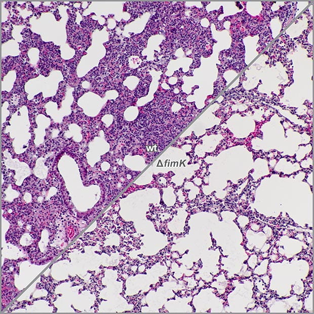 Image showing histology of lungs infected with wild-type Klebsiella pneumoniae in contrast to lungs infected with a fimK mutant.